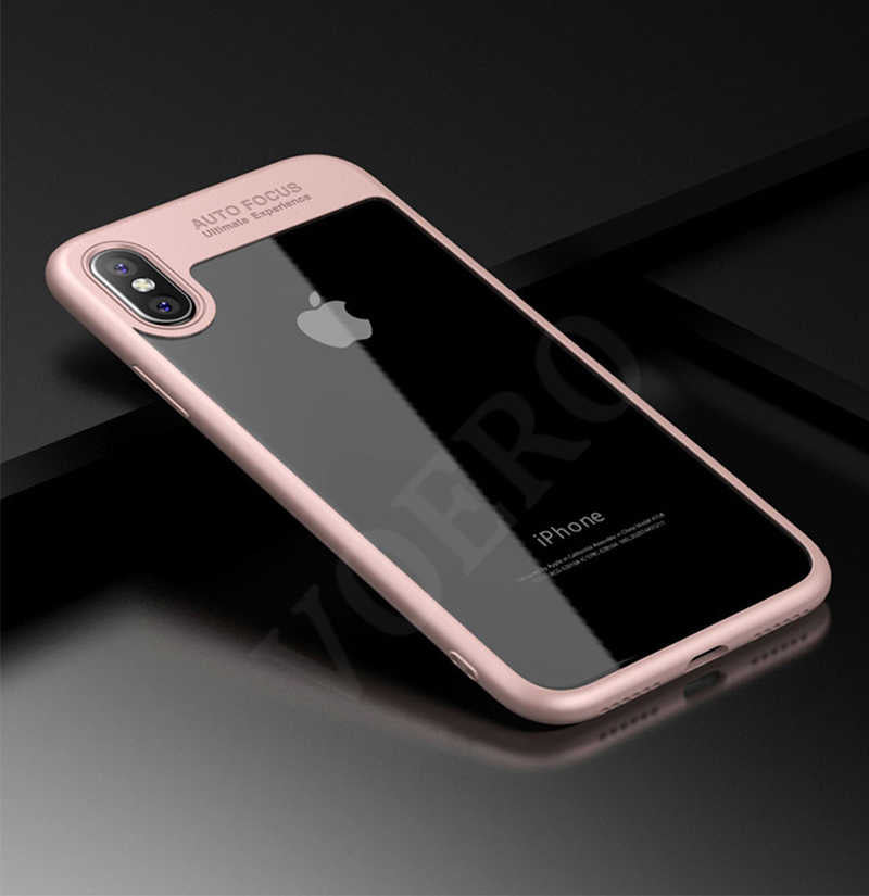 Apple iPhone X Uyumlu Kılıf Zore Buttom Kapak