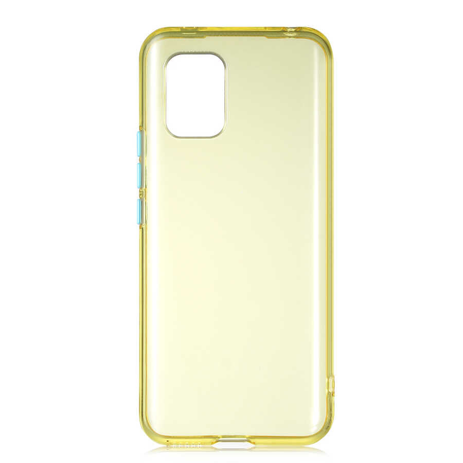 Xiaomi Mi 10 Lite Uyumlu Kılıf Zore Bistro Kapak
