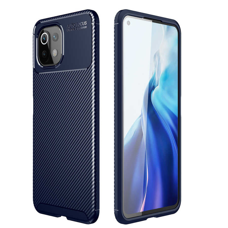 Xiaomi Mi 11 Lite Uyumlu Kılıf Zore Negro Silikon Kapak