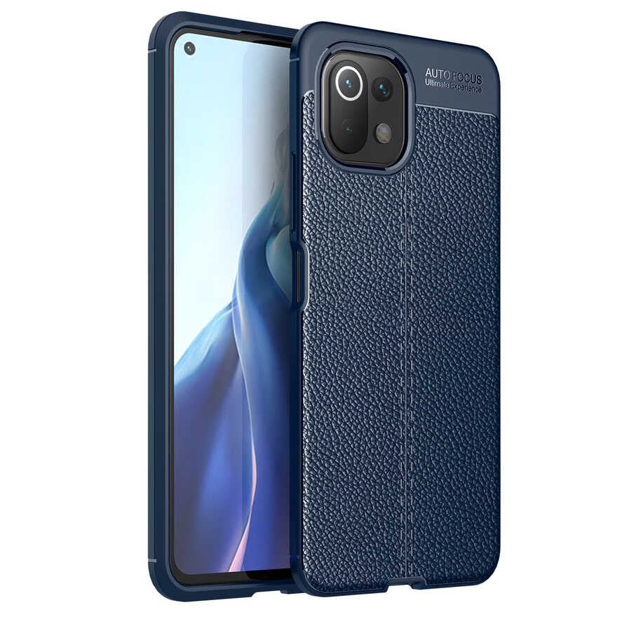 Xiaomi Mi 11 Lite Uyumlu Kılıf Zore Niss Silikon Kapak