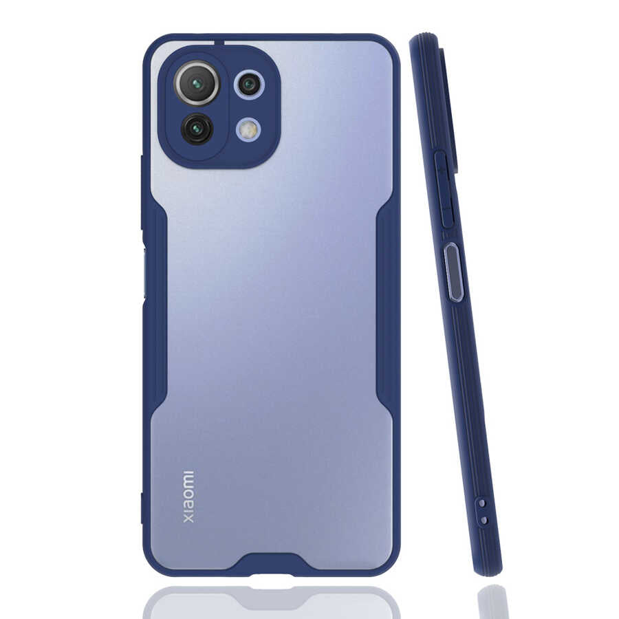Xiaomi Mi 11 Lite Uyumlu Kılıf Zore Parfe Kapak