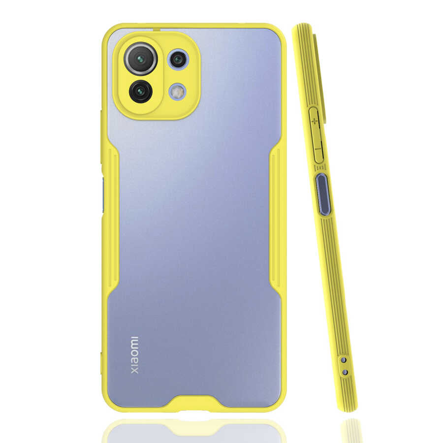 Xiaomi Mi 11 Lite Uyumlu Kılıf Zore Parfe Kapak