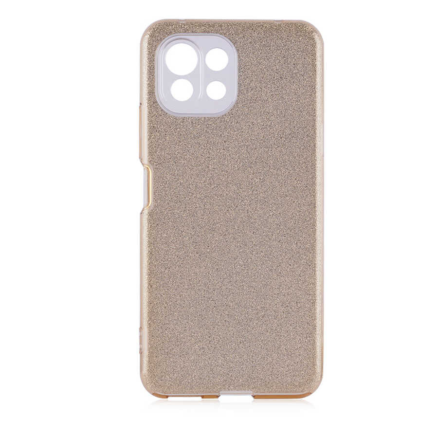Xiaomi Mi 11 Lite Uyumlu Kılıf Zore Shining Silikon