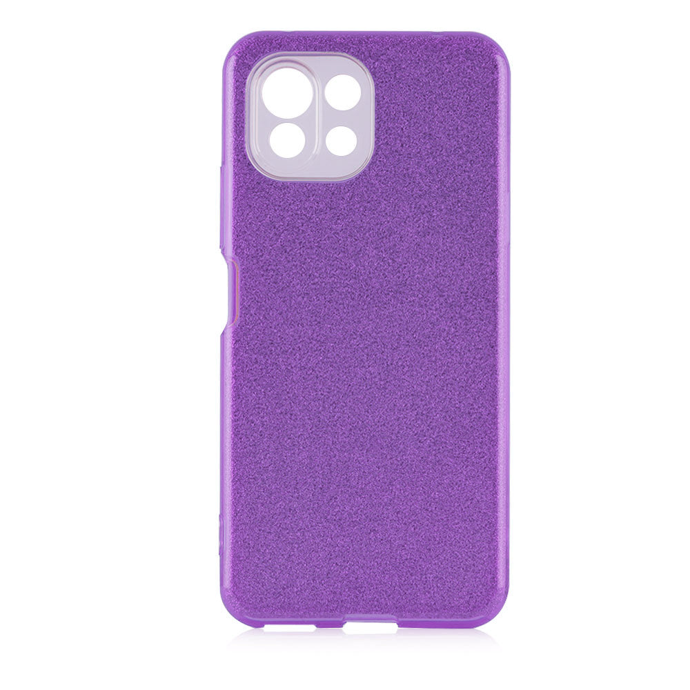 Xiaomi Mi 11 Lite Uyumlu Kılıf Zore Shining Silikon