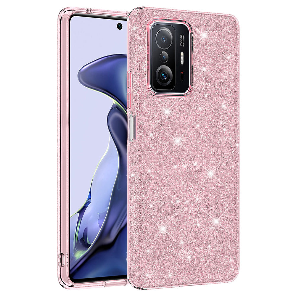 Xiaomi Mi 11T 5G Uyumlu Kılıf Zore Shining Silikon