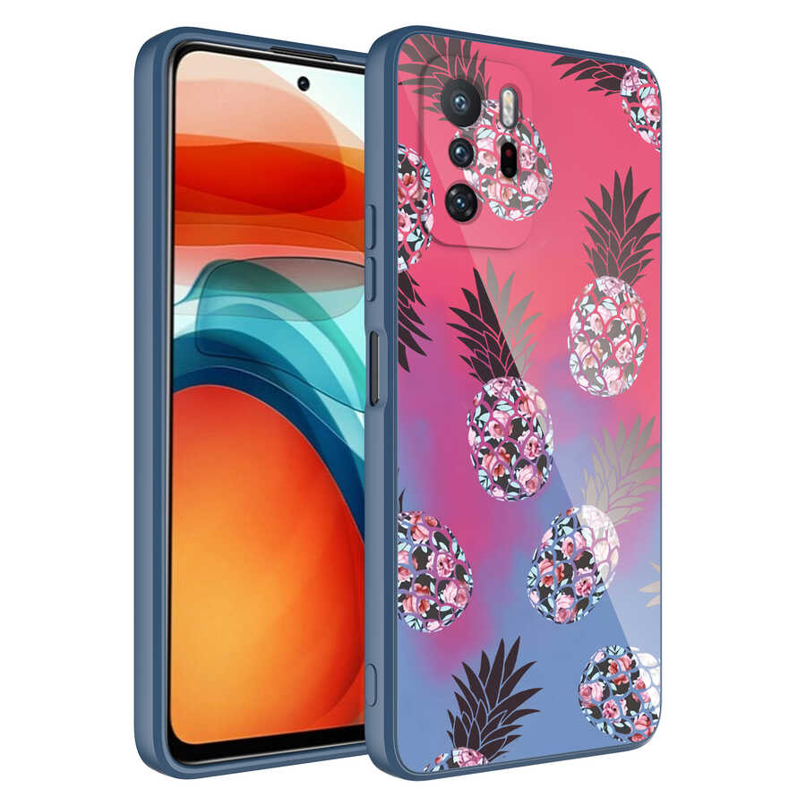 Xiaomi Redmi Note 10 Pro Uyumlu Kılıf Kamera Korumalı Desenli Sert Silikon Zore Epoksi Kapak